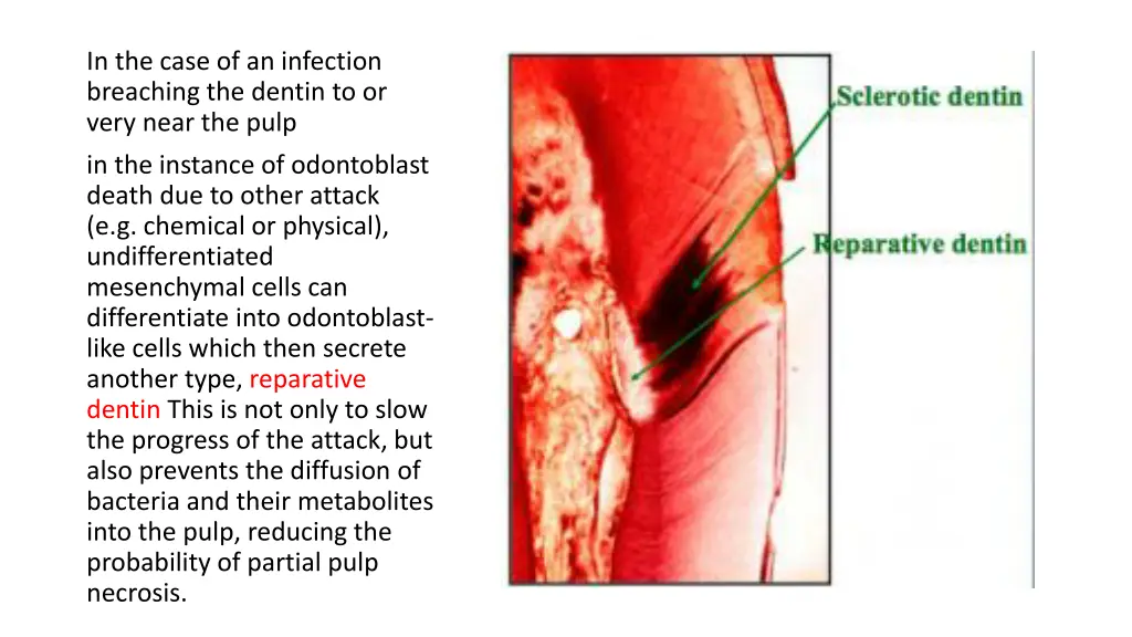 in the case of an infection breaching the dentin