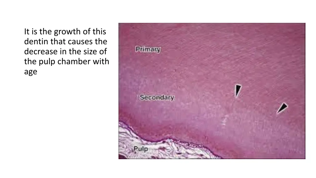 it is the growth of this dentin that causes