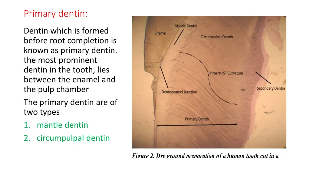 primary dentin