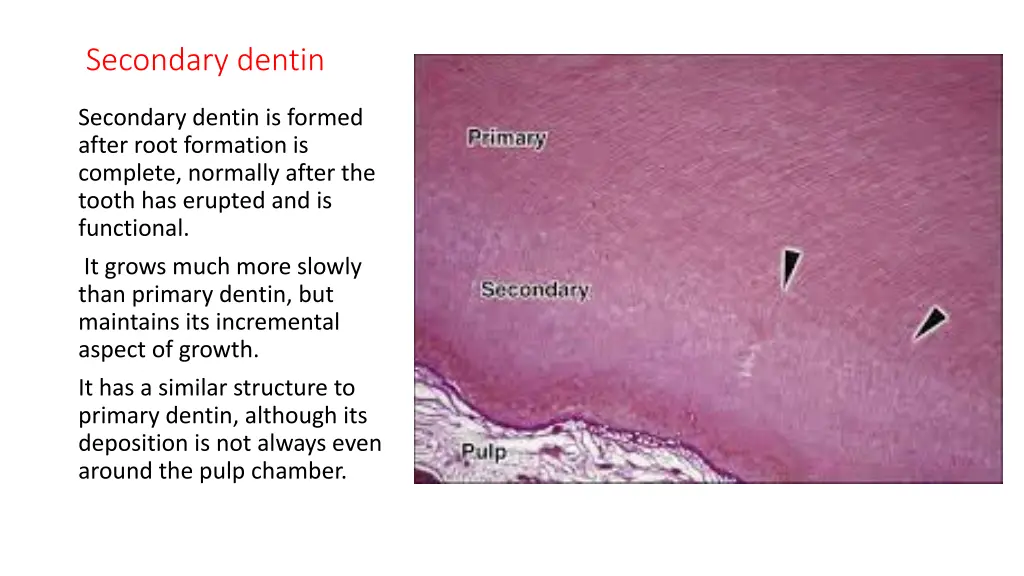 secondary dentin