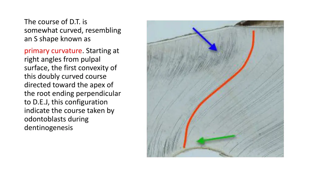 the course of d t is somewhat curved resembling