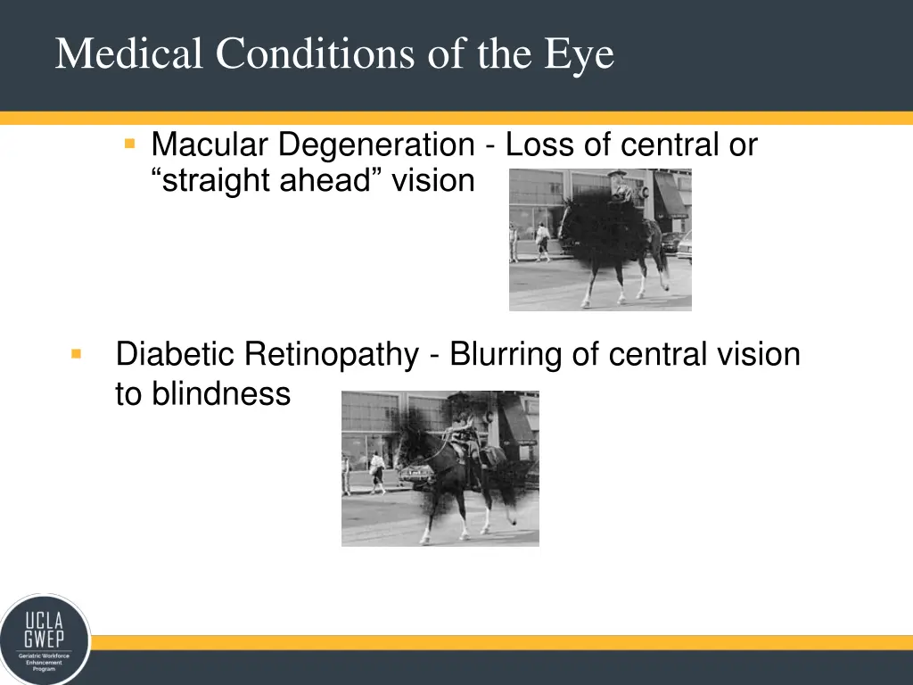 medical conditions of the eye 1