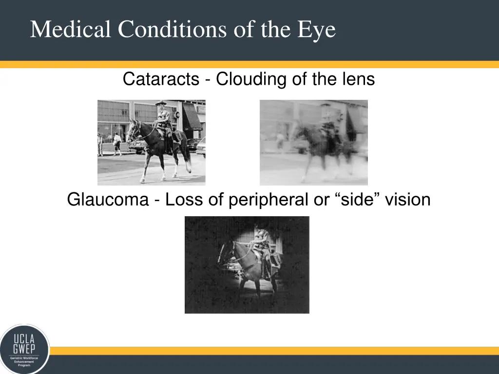 medical conditions of the eye