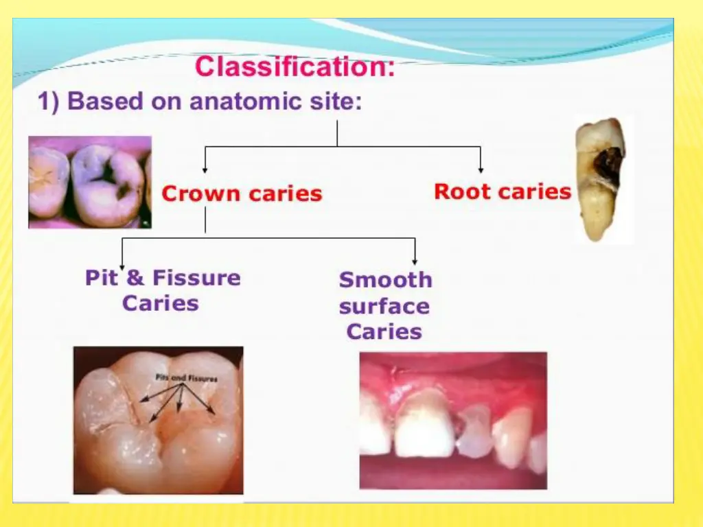 slide36