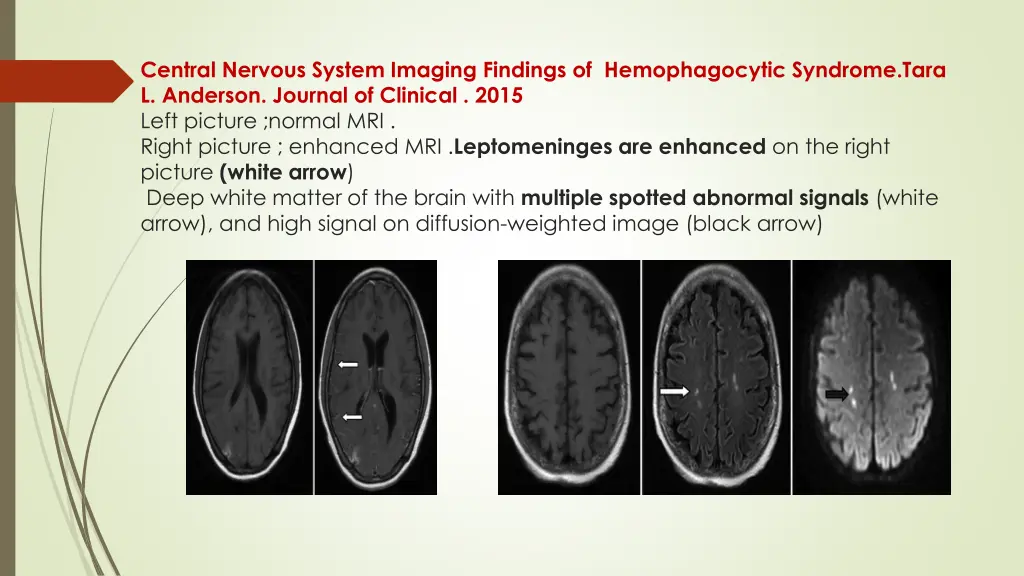 central nervous system imaging findings