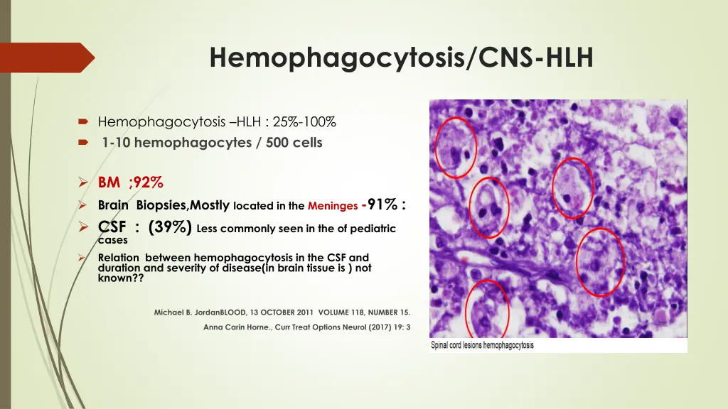 hemophagocytosis cns hlh