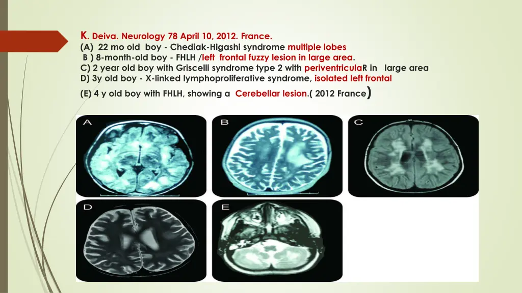 k deiva neurology 78 april 10 2012 france