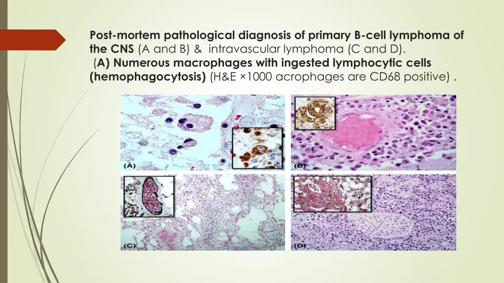 post mortem pathological diagnosis of primary