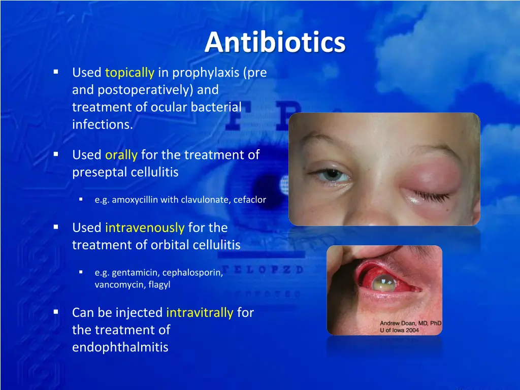 antibiotics 1