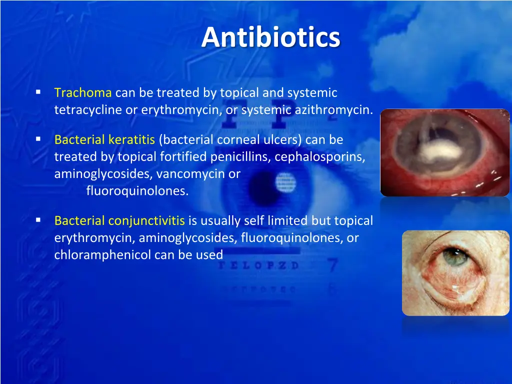 antibiotics 2