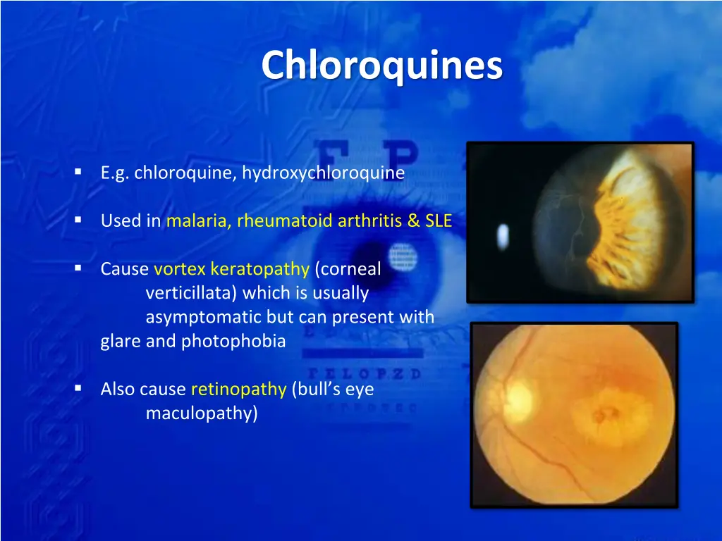 chloroquines