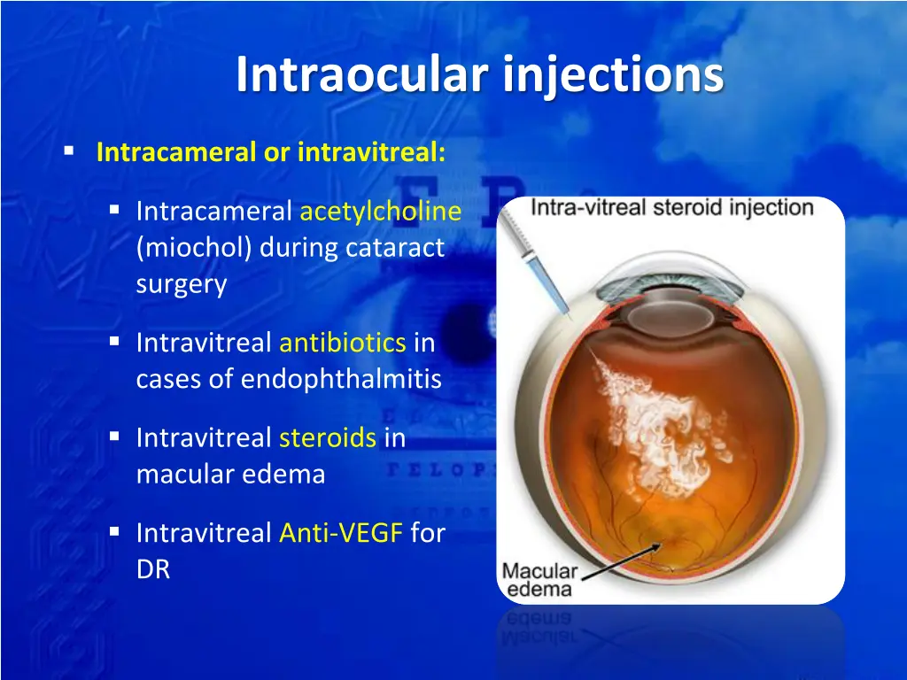 intraocular injections