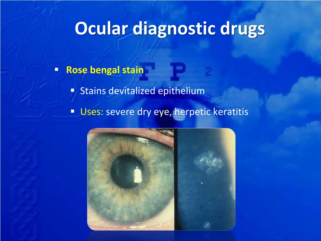 ocular diagnostic drugs 1