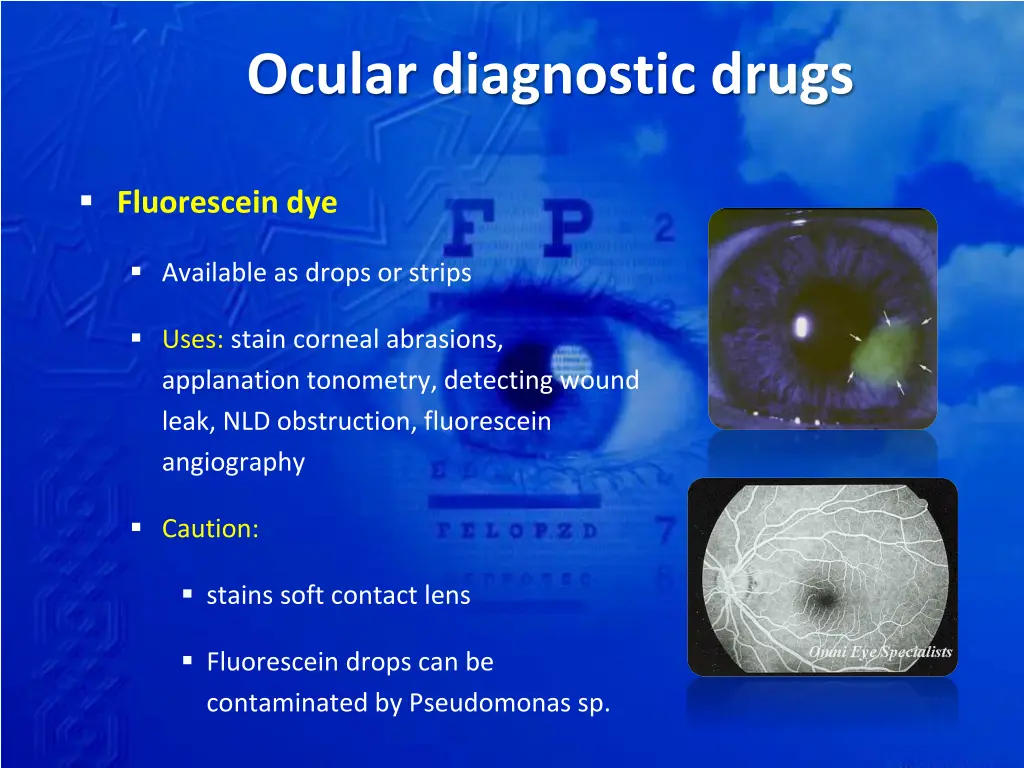 ocular diagnostic drugs