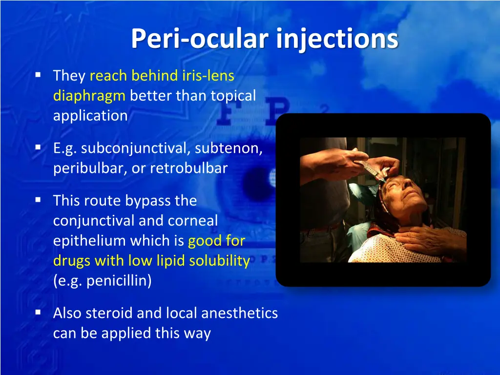 peri ocular injections