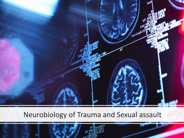 neurobiology of trauma and sexual assault