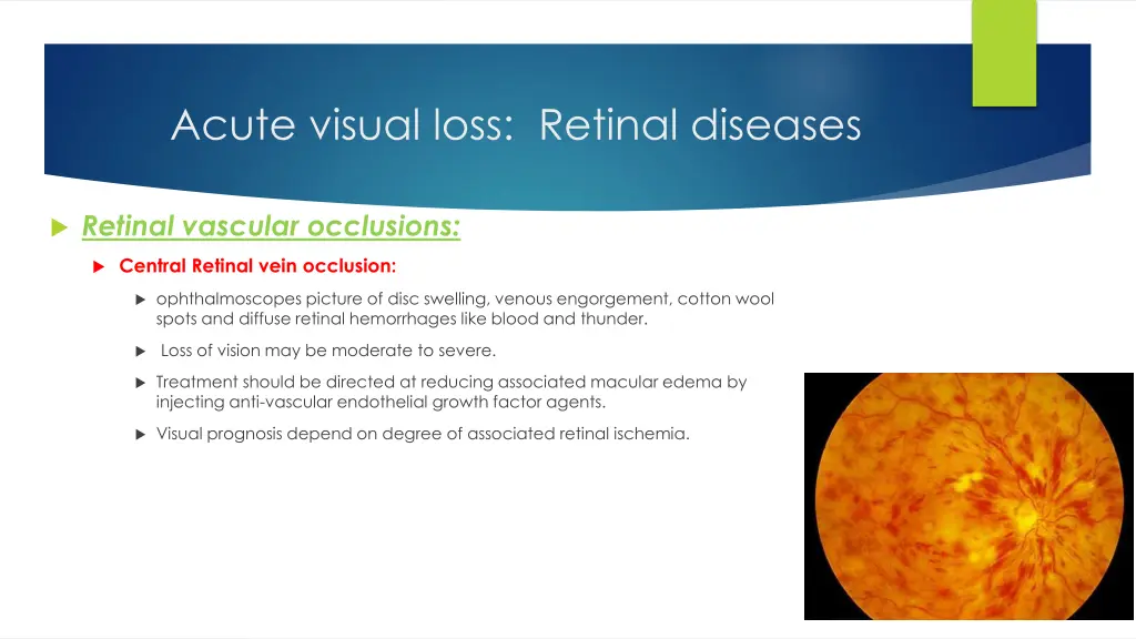 acute visual loss retinal diseases 1