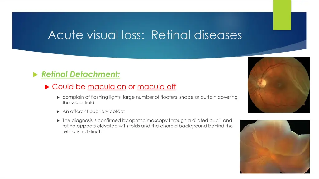 acute visual loss retinal diseases 2