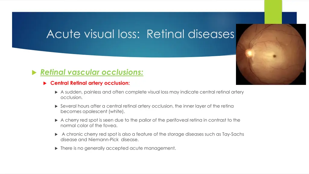 acute visual loss retinal diseases