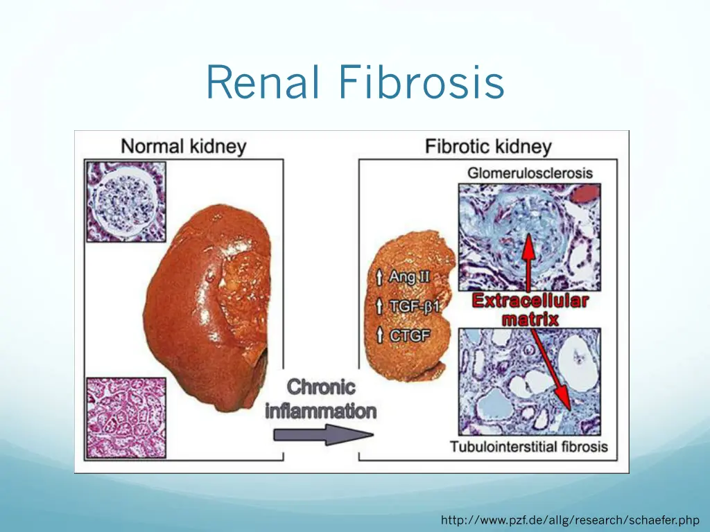 renal fibrosis