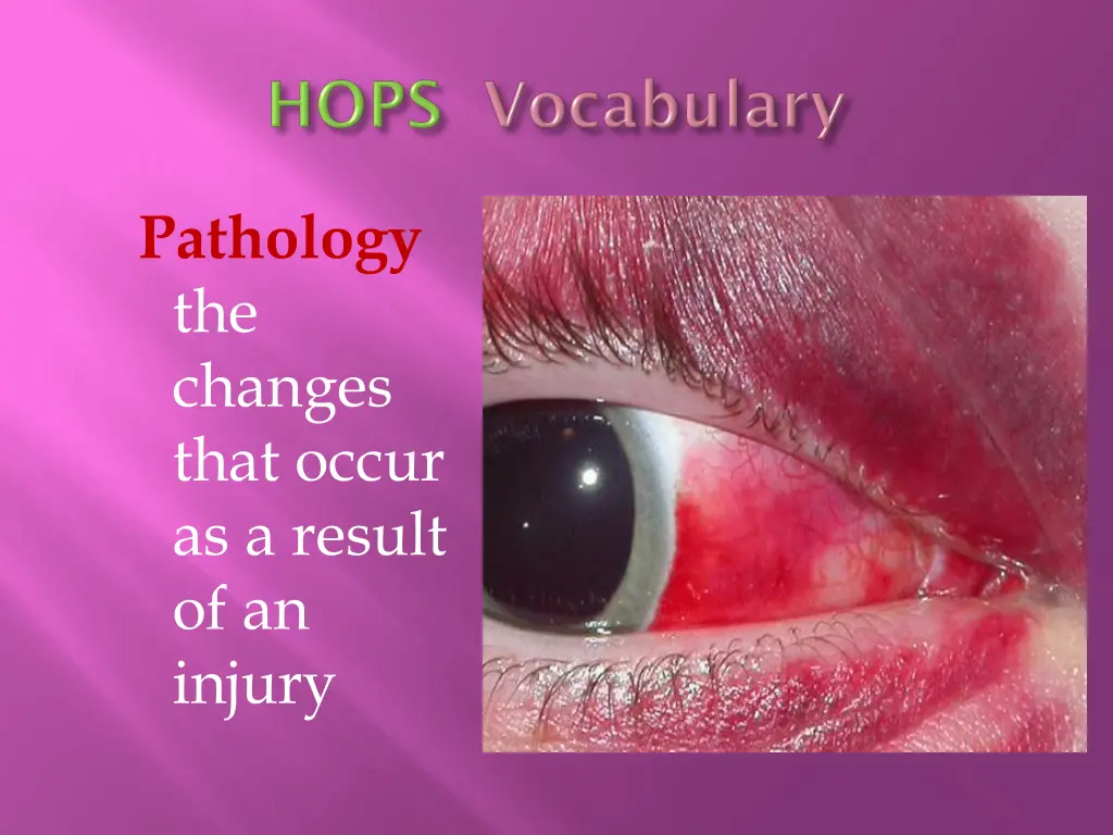 pathology the changes that occur as a result