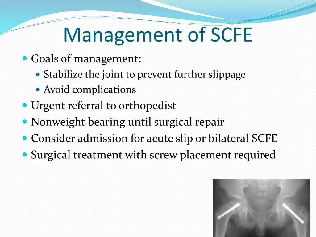 management of scfe