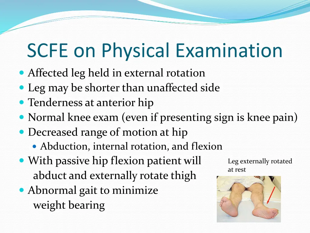 scfe on physical examination affected leg held