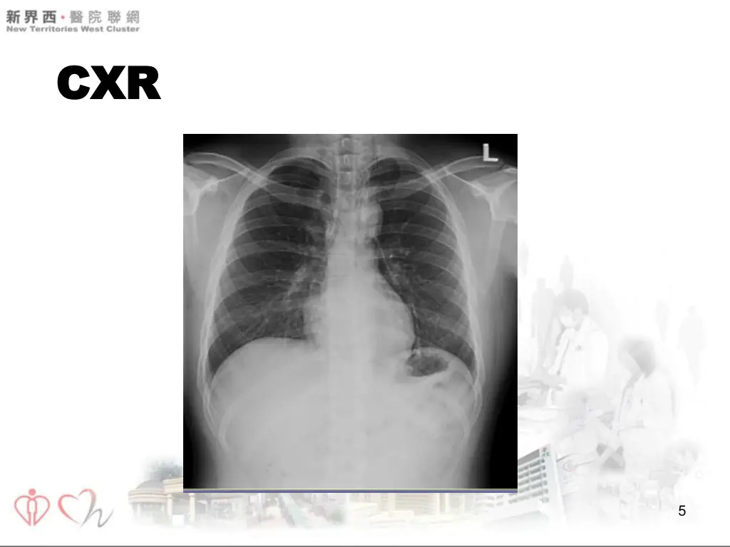 cxr cxr