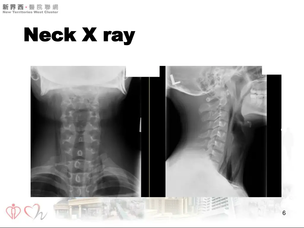 neck x ray neck x ray