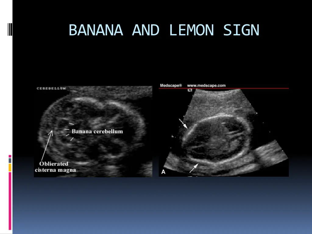 banana and lemon sign