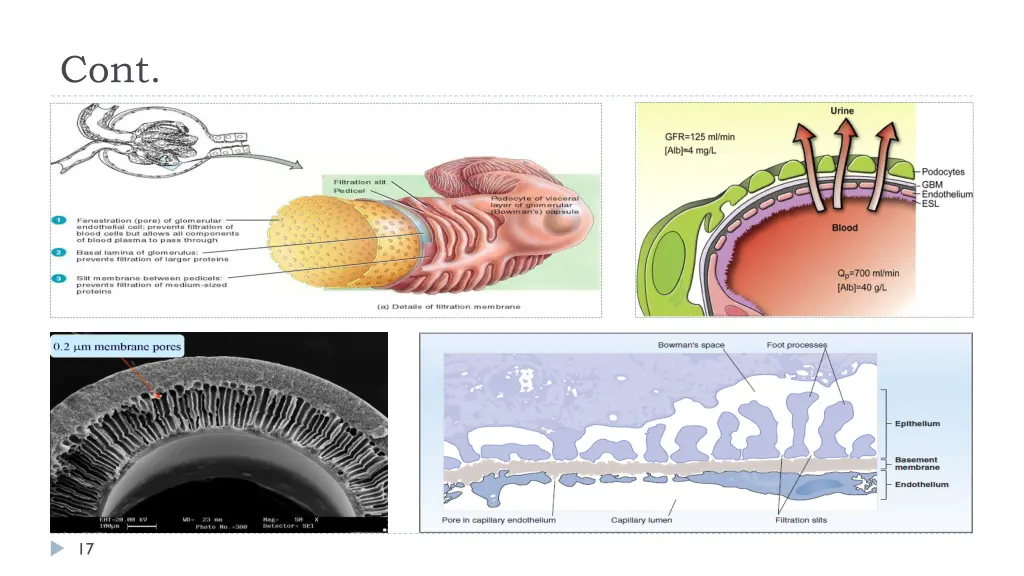 slide17