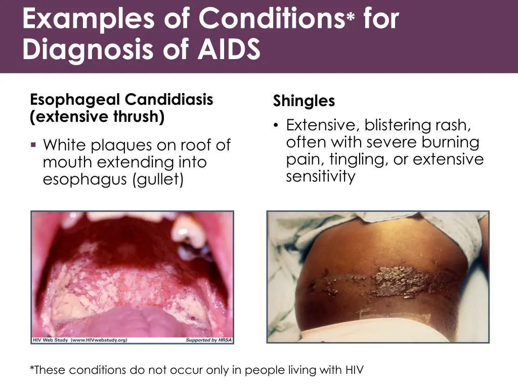 examples of conditions for diagnosis of aids