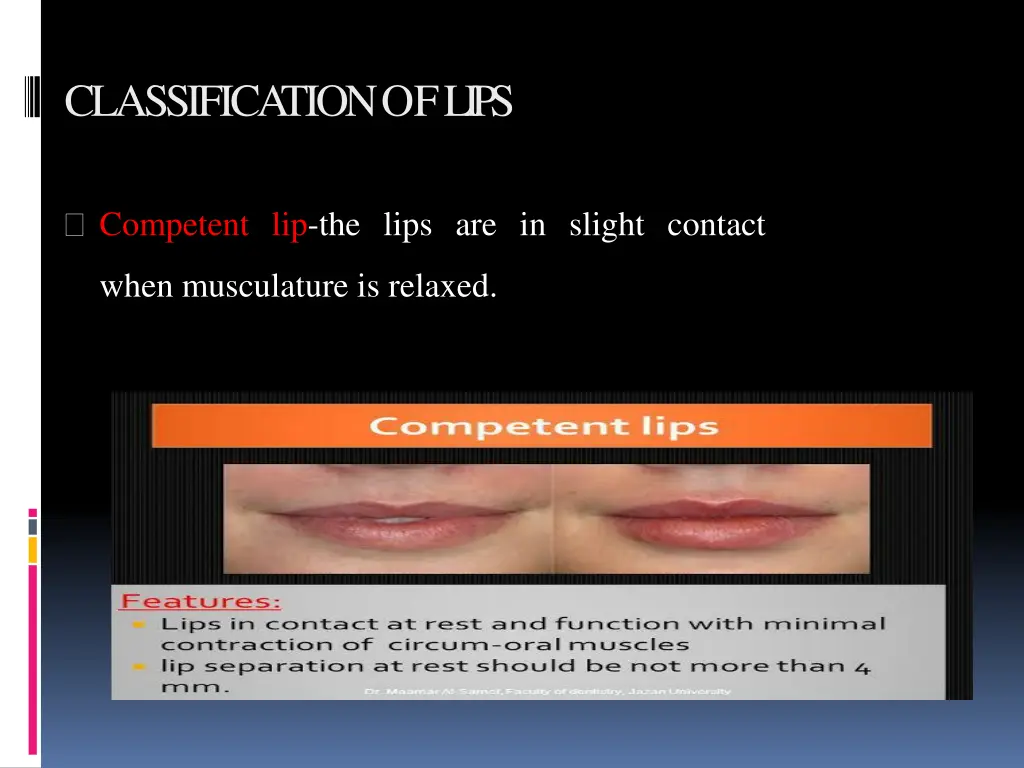 classificationoflips