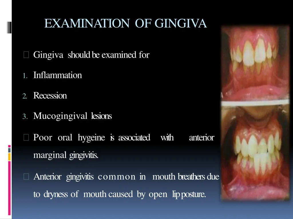 examination of gingiva