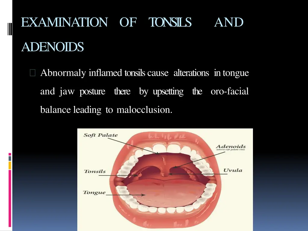 examination of tonsils