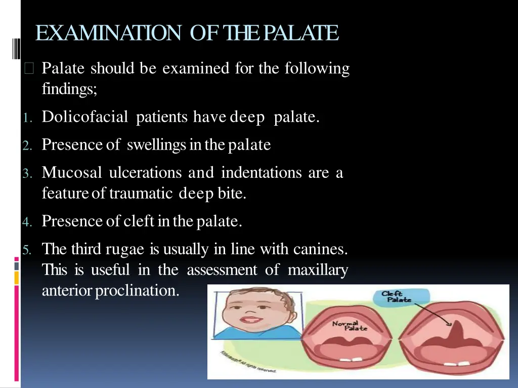 examination ofthepalate