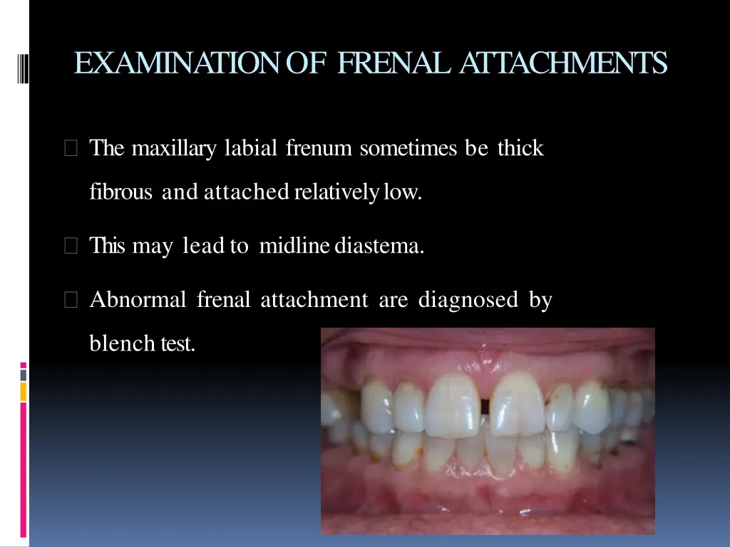 examinationof frenalattachments