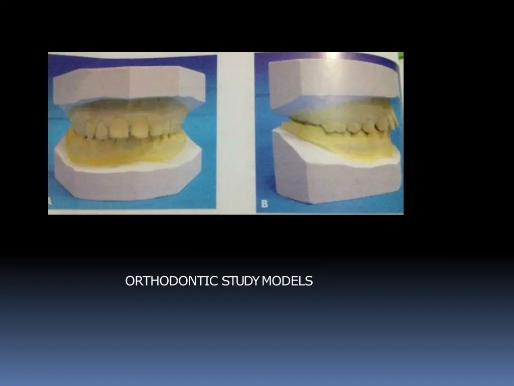 orthodontic studymodels