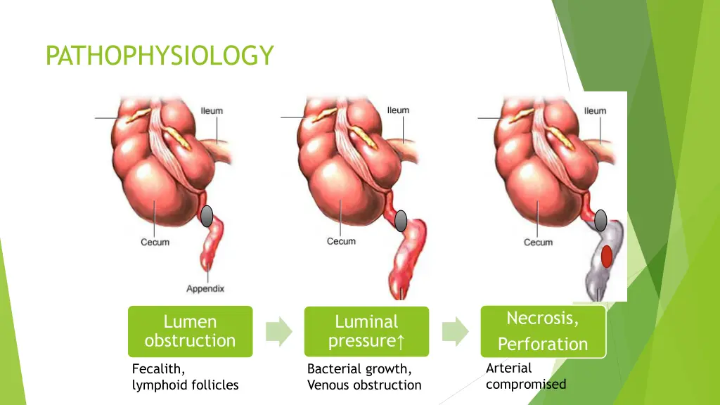 pathophysiology