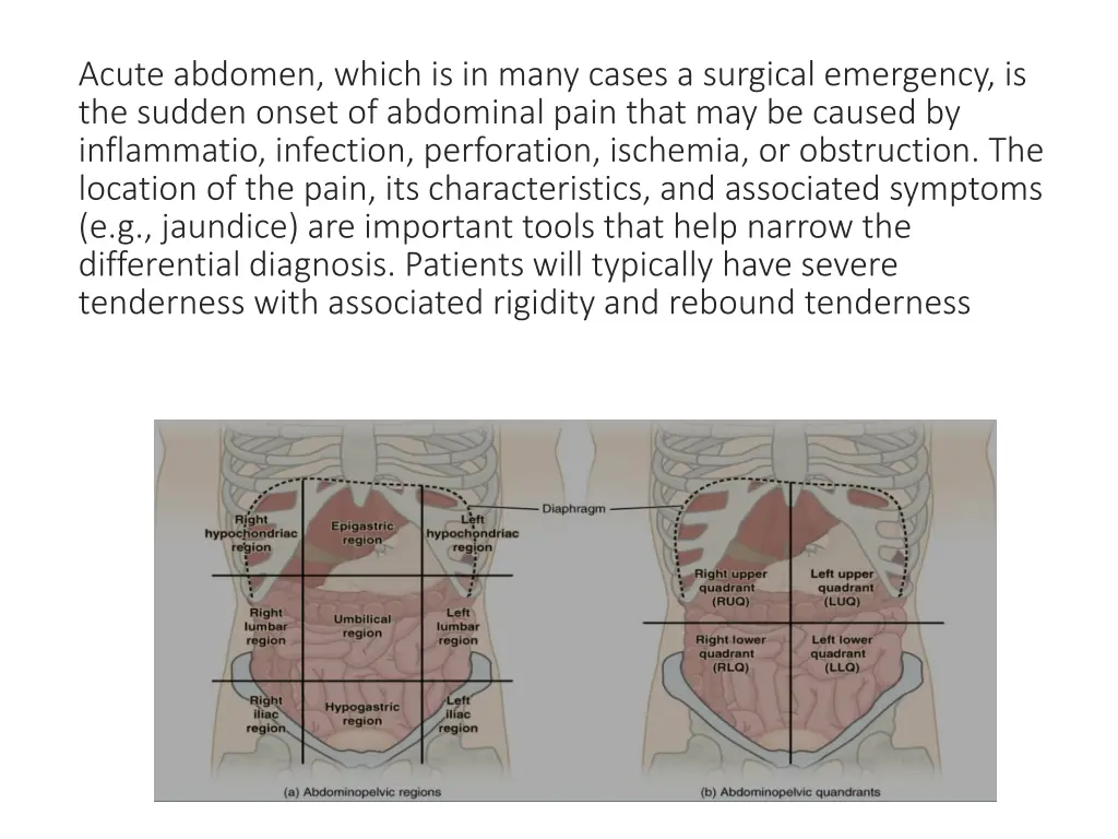 acute abdomen which is in many cases a surgical