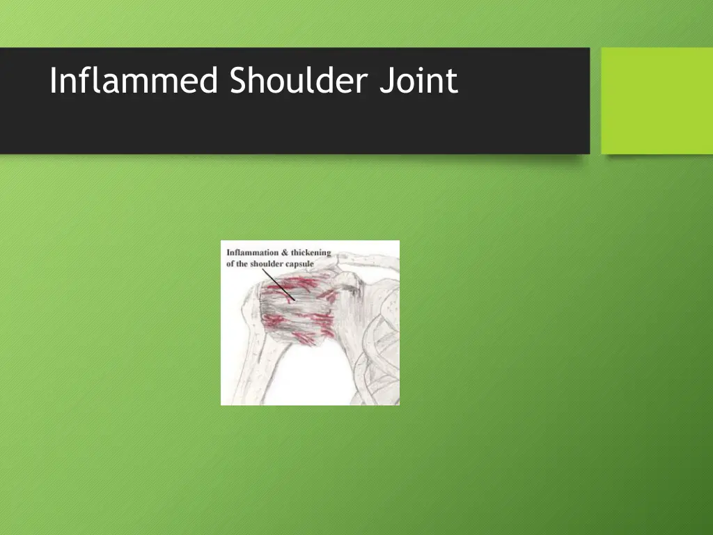 inflammed shoulder joint