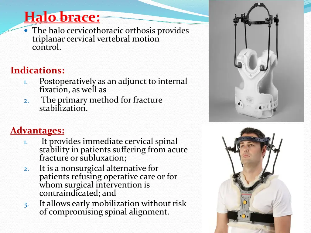 halo brace the halo cervicothoracicorthosis