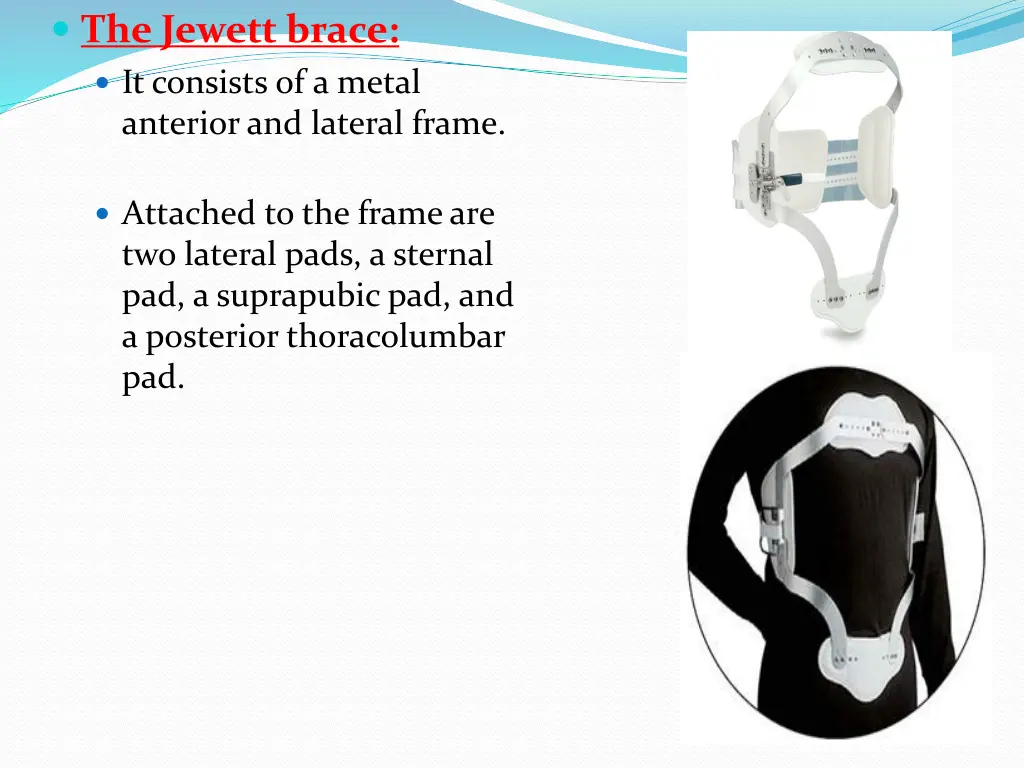 the jewett brace