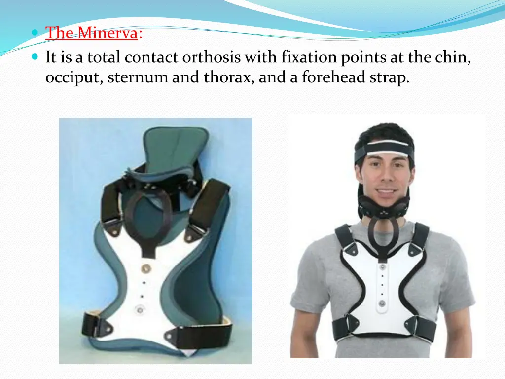 the minerva it is a total contact orthosis with