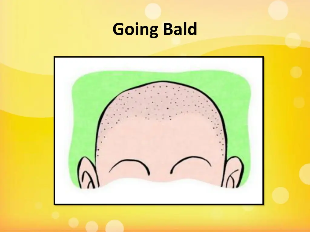 going bald