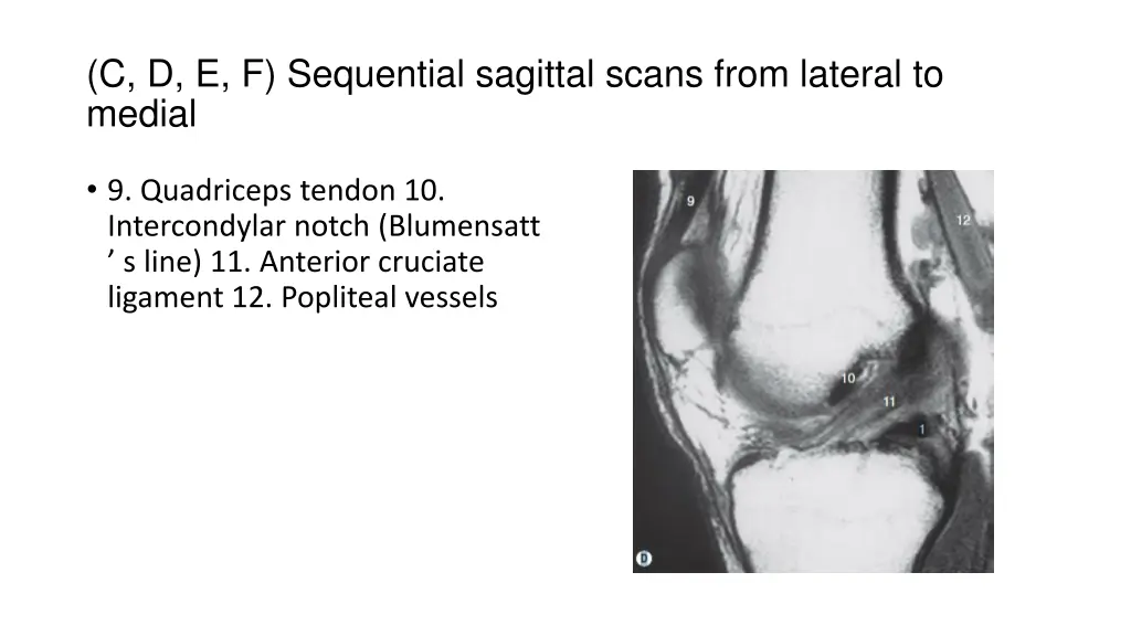 c d e f sequential sagittal scans from lateral 1