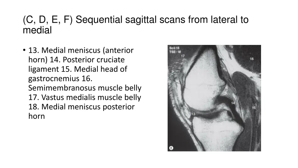 c d e f sequential sagittal scans from lateral 2