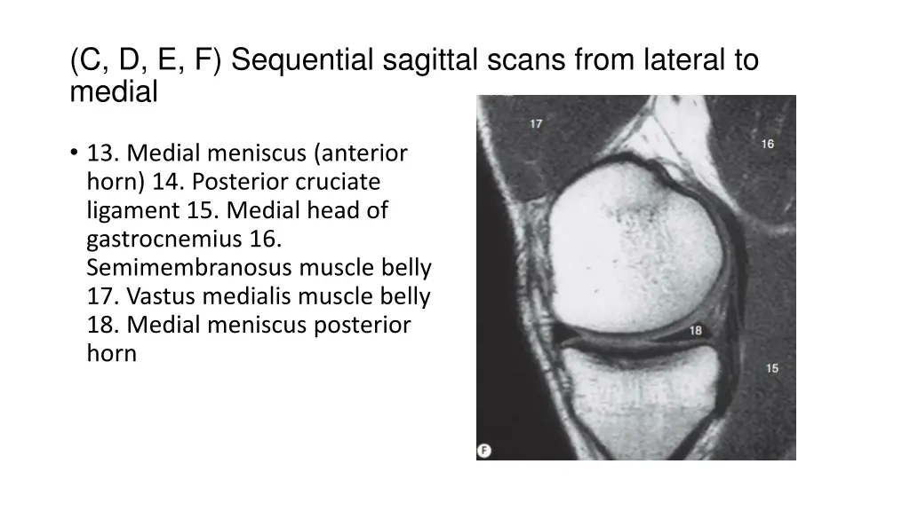 c d e f sequential sagittal scans from lateral 3