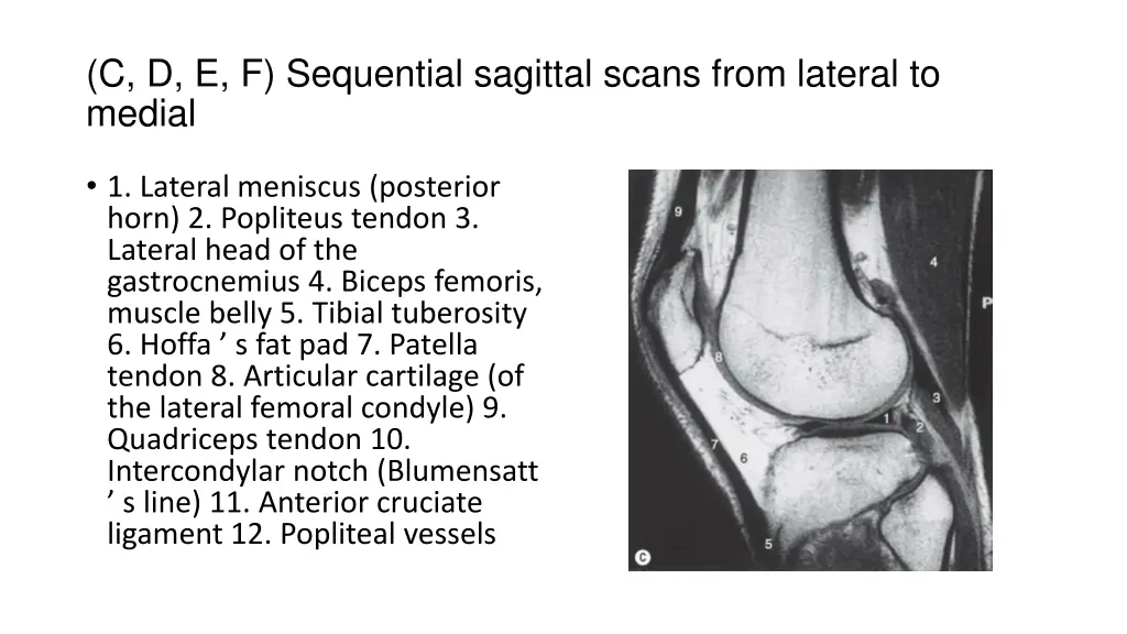 c d e f sequential sagittal scans from lateral