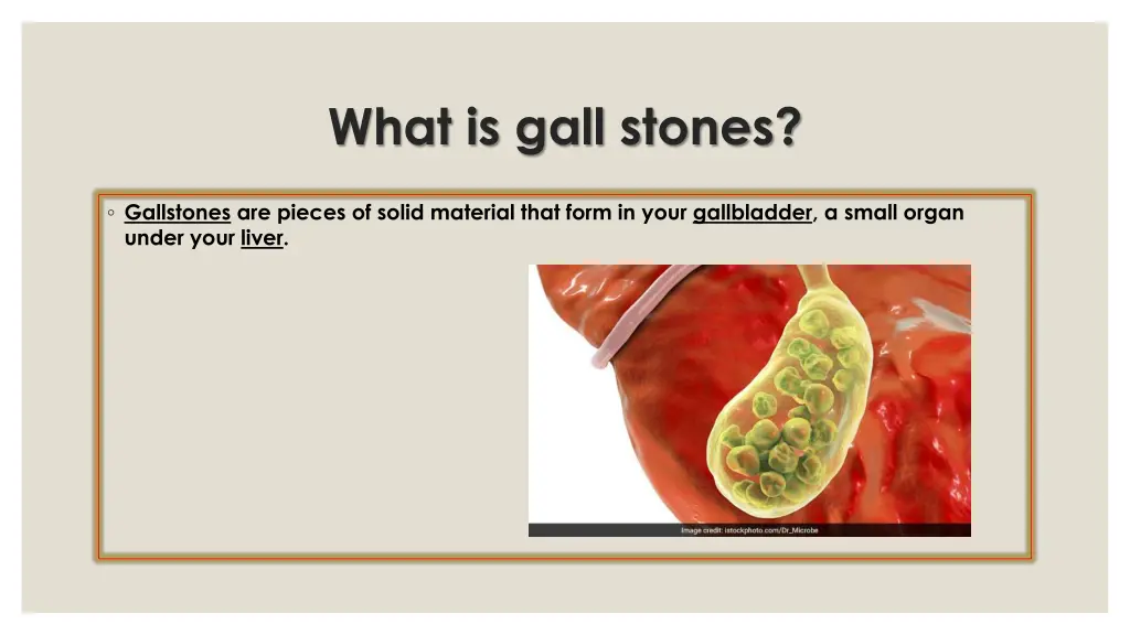 what is gall stones